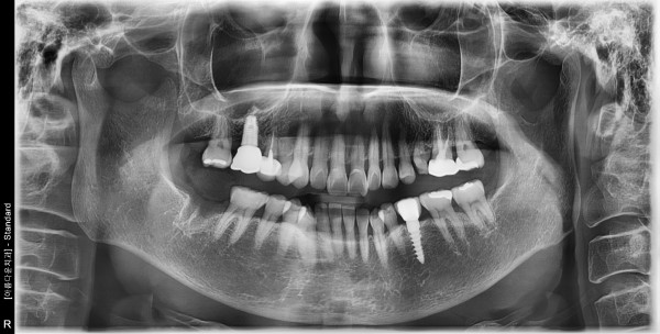 fc3b3f57b4fbd4e786774e53e2fe73a7_1761535