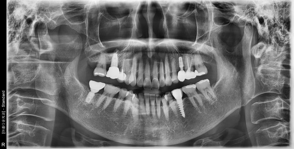 fc3b3f57b4fbd4e786774e53e2fe73a7_1761535